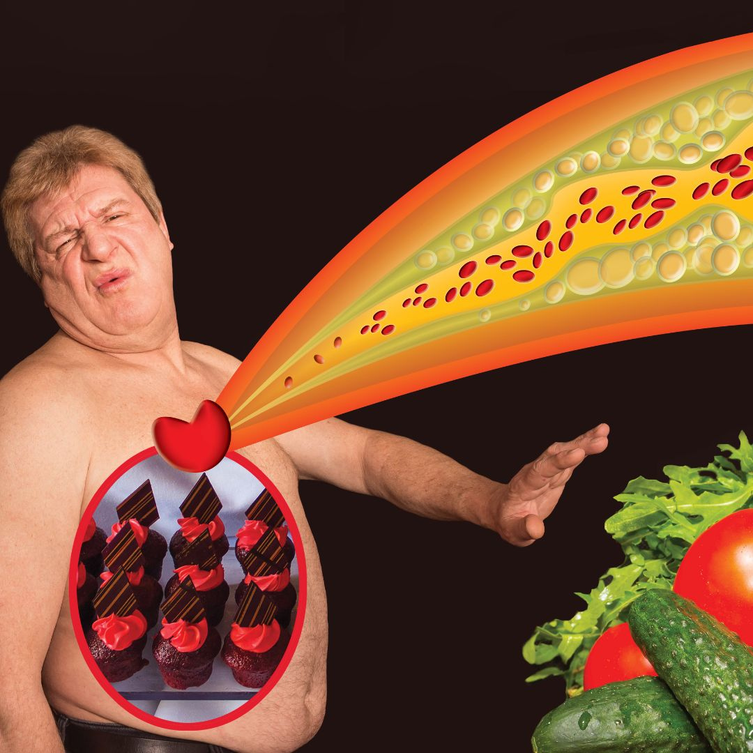 Cholesterol Diet